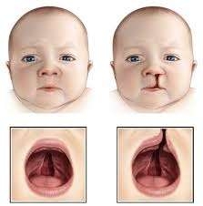 İstanbul Konuşma Terapisti