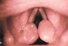 İstanbul Konuşma Terapisti