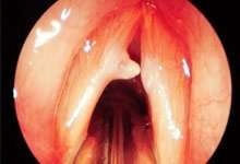 İstanbul Konuşma Terapisti