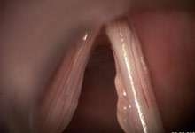 İstanbul Konuşma Terapisti